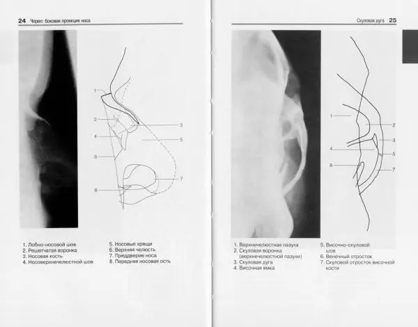 Торстен Мёллер - Карманный атлас рентгенологической анатомии - Страница № 19