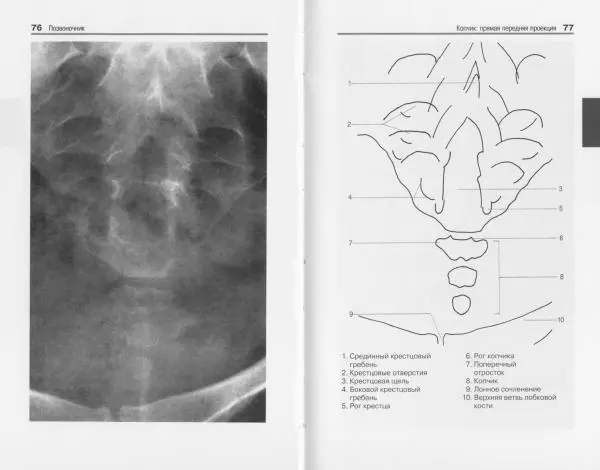 Торстен Мёллер - Карманный атлас рентгенологической анатомии - Страница № 45