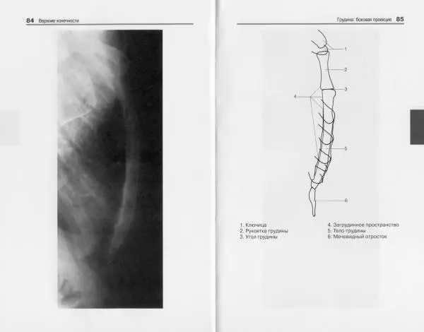 Торстен Мёллер - Карманный атлас рентгенологической анатомии - Страница № 49