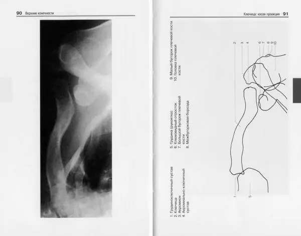 Торстен Мёллер - Карманный атлас рентгенологической анатомии - Страница № 52