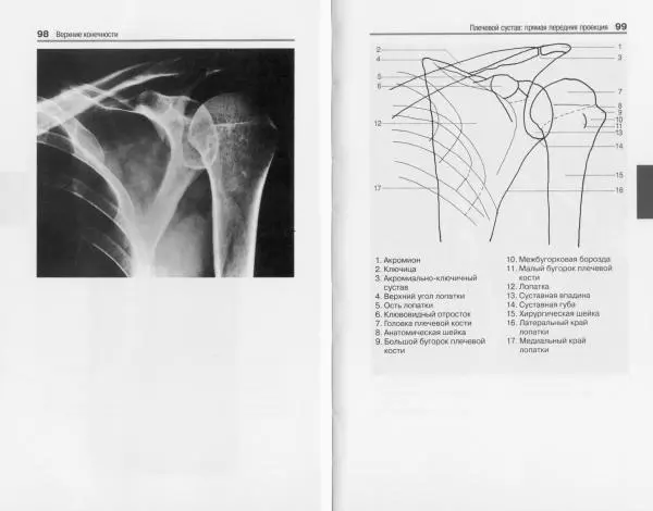 Торстен Мёллер - Карманный атлас рентгенологической анатомии - Страница № 56