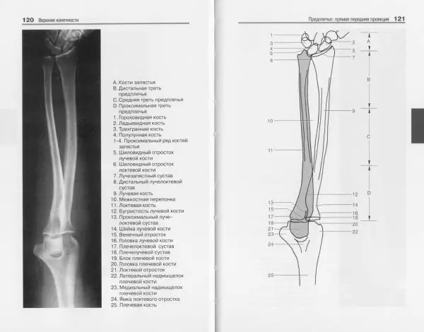 Торстен Мёллер - Карманный атлас рентгенологической анатомии - Страница № 67
