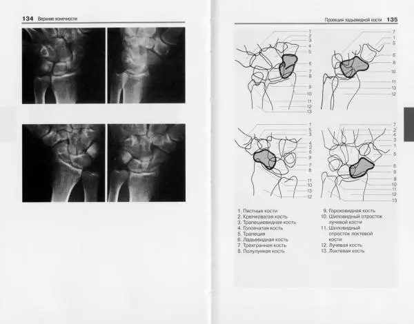 Торстен Мёллер - Карманный атлас рентгенологической анатомии - Страница № 74