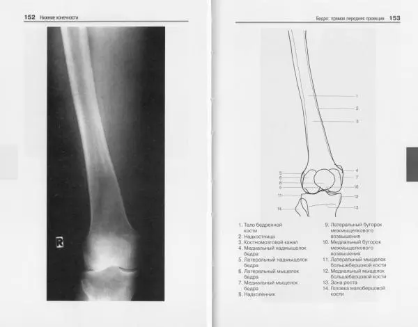 Торстен Мёллер - Карманный атлас рентгенологической анатомии - Страница № 83