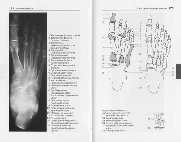 Торстен Мёллер - Карманный атлас рентгенологической анатомии - Страница № 93