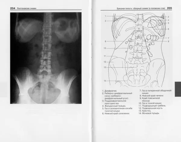 Торстен Мёллер - Карманный атлас рентгенологической анатомии - Страница № 109