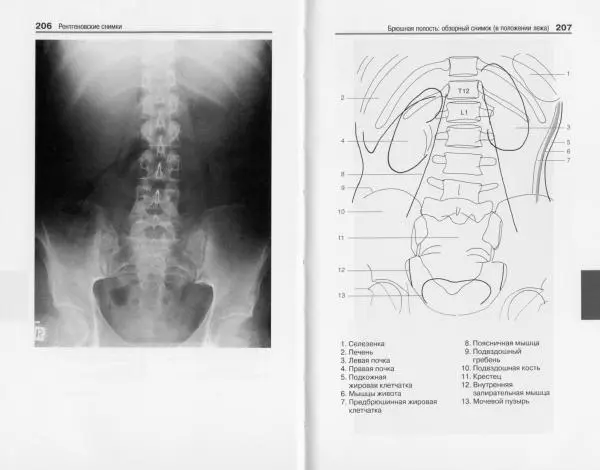 Торстен Мёллер - Карманный атлас рентгенологической анатомии - Страница № 110