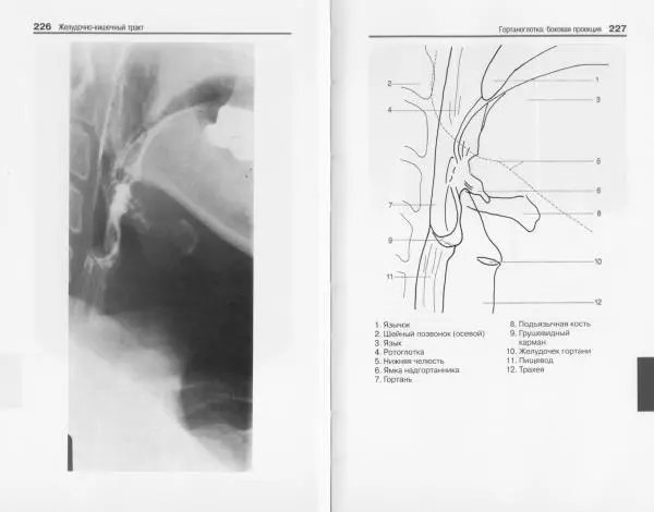 Торстен Мёллер - Карманный атлас рентгенологической анатомии - Страница № 120