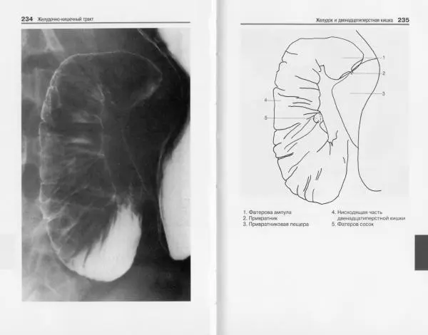 Торстен Мёллер - Карманный атлас рентгенологической анатомии - Страница № 124