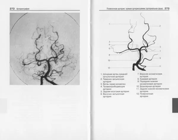 Торстен Мёллер - Карманный атлас рентгенологической анатомии - Страница № 143