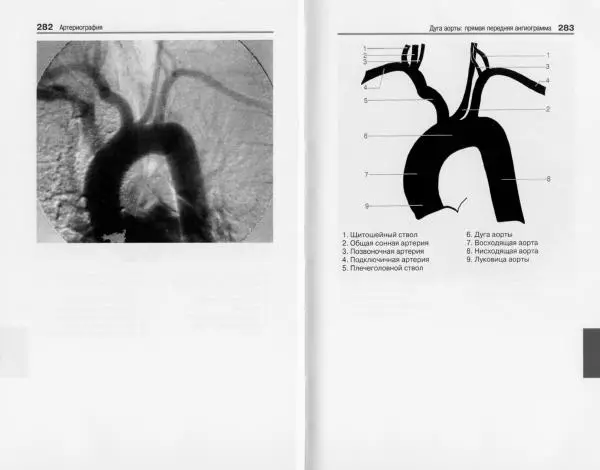 Торстен Мёллер - Карманный атлас рентгенологической анатомии - Страница № 148