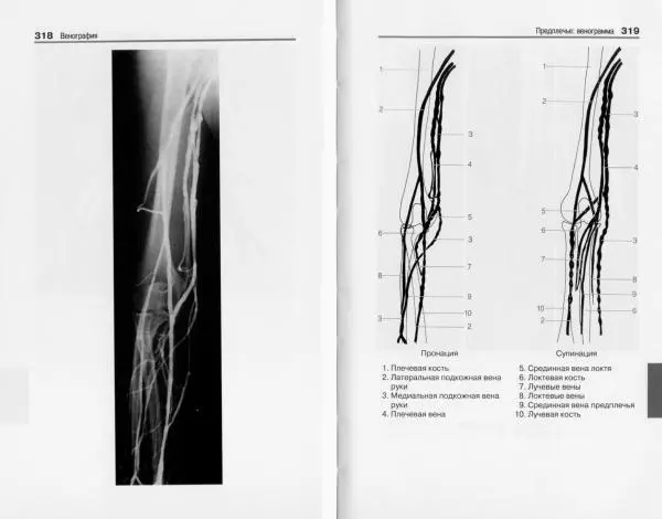 Торстен Мёллер - Карманный атлас рентгенологической анатомии - Страница № 166