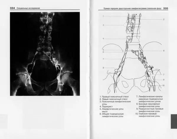 Торстен Мёллер - Карманный атлас рентгенологической анатомии - Страница № 174