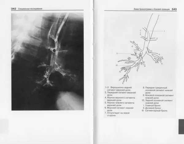 Торстен Мёллер - Карманный атлас рентгенологической анатомии - Страница № 178