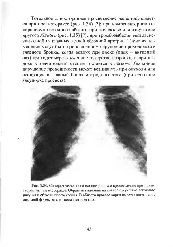  Коллектив авторов - Практические навыки и неотложная терапия в клинике внутренних болезней - Страница № 44